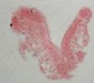 Mikropräparat von Trichoplax adhaerens