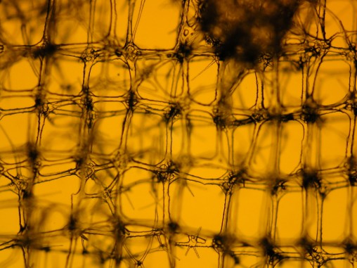 Glasschwammskelett