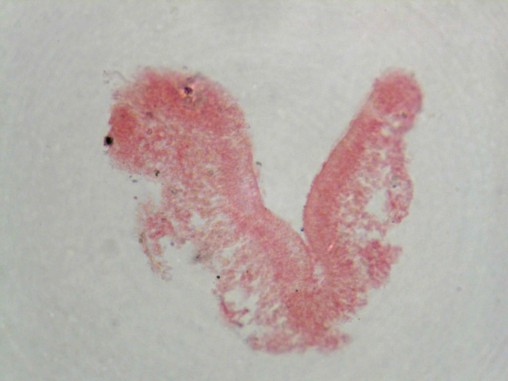 Mikropräparat von Trichoplax adhaerens
