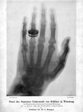 Hand des Anatomen Albert von Kölliker